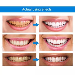 POSLEDNÍ DEN 50%VÝHODY - bělení zubů pera